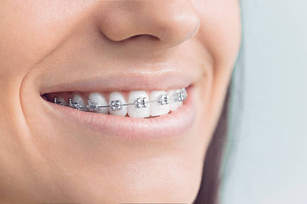 Dental Bonding in Colfax, WI